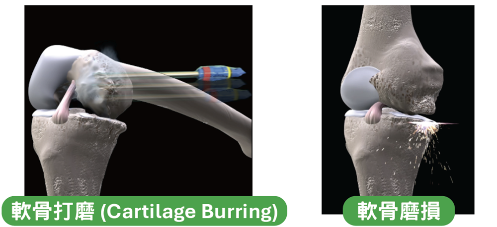 Burring Diagram
